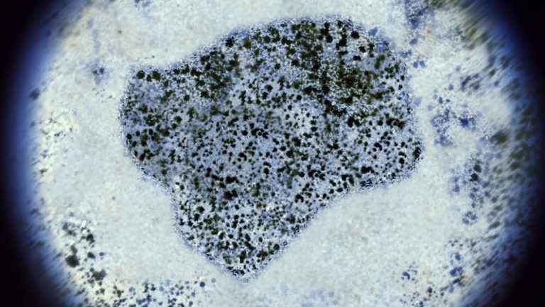 球差电镜（AC-TEM）