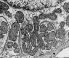 生物透射电镜(生物TEM)